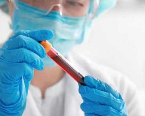 国内正规的供卵机构,促排时要好好观察卵泡形状发现不对劲就要采取措施